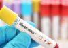 बंगाल में निपाह वायरस (Nipah Virus) के संदिग्ध मामले: स्वास्थ्य मंत्रालय अलर्ट मोड पर, केंद्र ने दिया पूर्ण राज्य सहयोग का कड़ा आश्वासन!